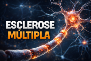 Dúvidas sobre Esclerose Múltipla